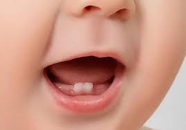 دندان های شیری کی شروع به رویش می کنند؟